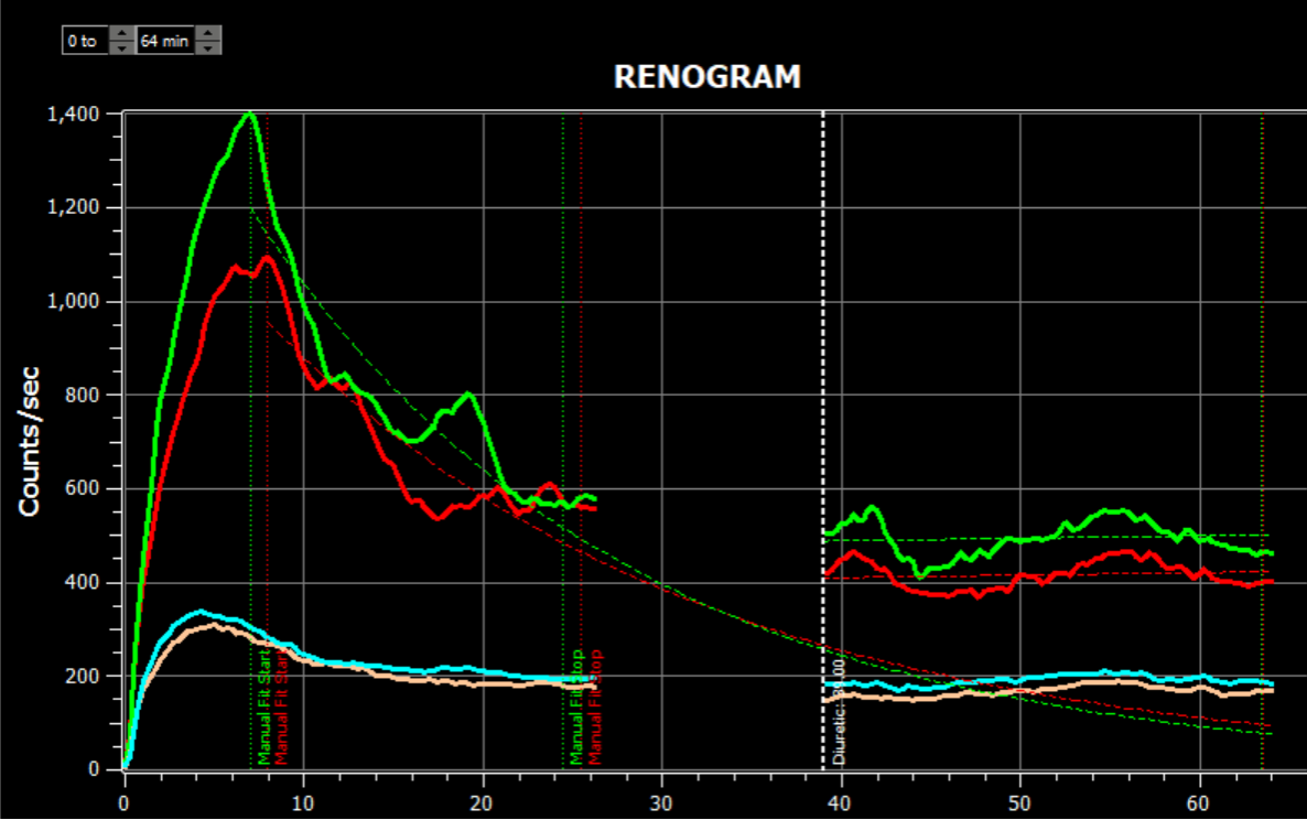 Renogram